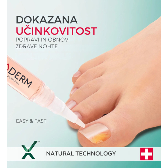 Prikazujem sliko PODERM® Serum – pero proti glivicam na nohtih Slika produkta PODERM® Serum – pero proti glivicam na nohtih