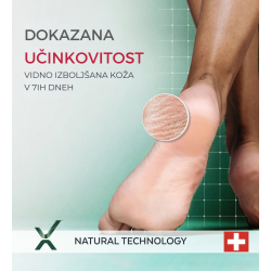 PODERM® Serum za zelo suha in poškodovana stopala, 75 ml