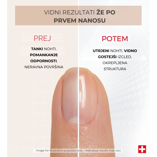Prikazana slika PODERM® Korektivni lak za nokte s keratinom, 8 ml Slika proizvoda PODERM® Korektivni lak za nokte s keratinom, 8 ml