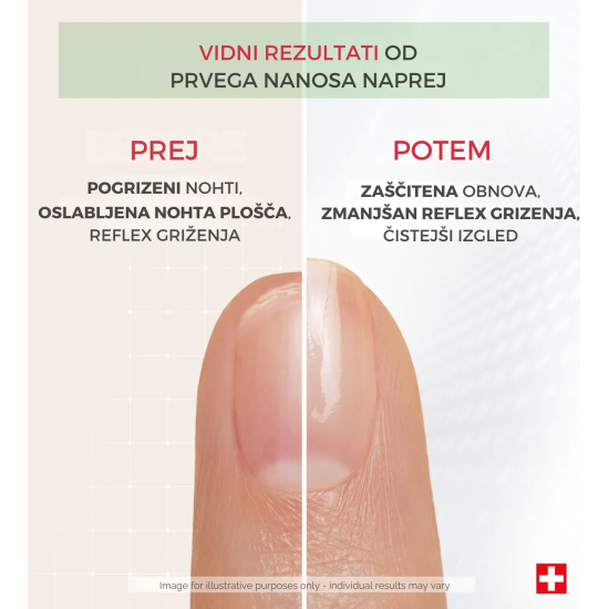 Slika proizvoda PODERM® Korektivni lak za nokte s proteinima, 8 ml