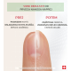 Slika proizvoda PODERM® Korektivni lak za nokte s proteinima, 8 ml