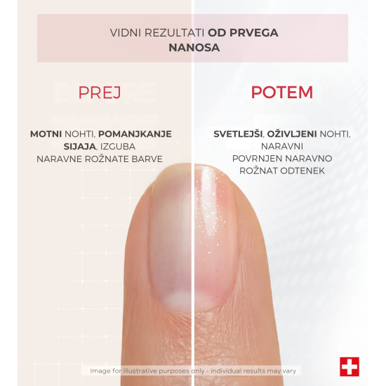 Slika produkta PODERM® Korektivni lak za nohte z biopeptidi, 8 ml