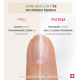 Prikazujem sliko PODERM® Korektivni lak za nohte z mineralnim sijajem, 8 ml Slika produkta PODERM® Korektivni lak za nohte z mineralnim sijajem, 8 ml