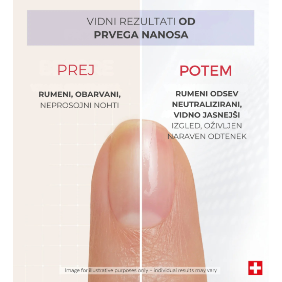 Prikazujem sliko PODERM® Korektivni lak za nohte za nevtralizacijo rumenih nohtov, 8 ml Slika produkta PODERM® Korektivni lak za nohte za nevtralizacijo rumenih nohtov, 8 ml