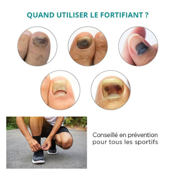 Slika proizvoda PODERM® Serum za oštećene nokte i hematome (8 ml)